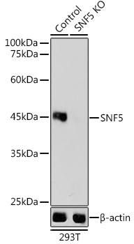 Anti-SNF5 Antibody [KO Validated] (CAB3247)