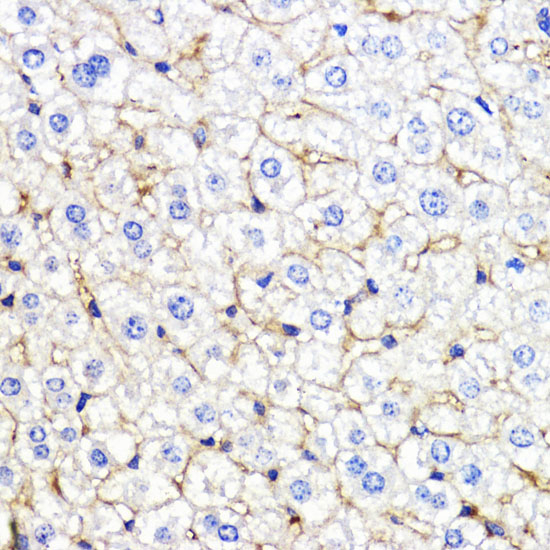 Anti-BMPR1B Antibody (CAB2005)