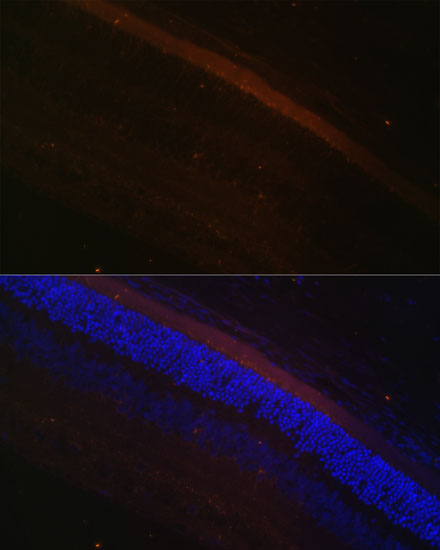 Anti-GRK1 Antibody (CAB6497)