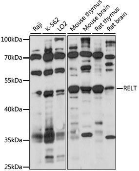 Anti-RELT Antibody (CAB15540)