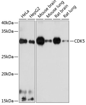 Anti-CDK5 Antibody (CAB19029)