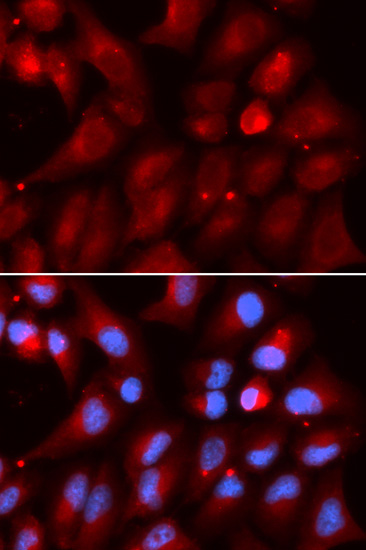 Anti-PSMB2 Antibody (CAB5483)