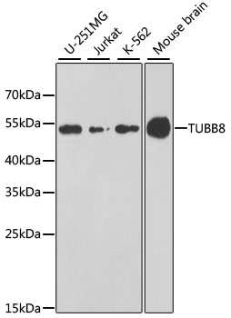 Anti-TUBB8 Polyclonal Antibody (CAB8396)