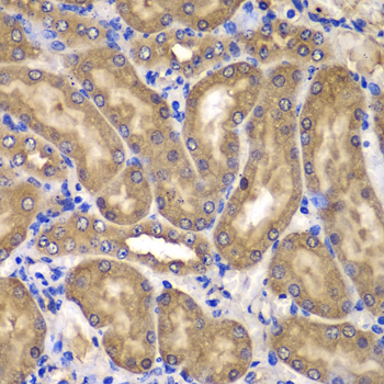 Anti-NME2 Antibody (CAB7443)