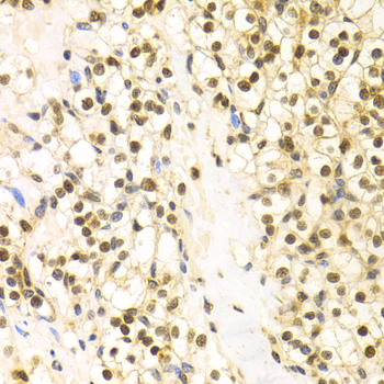 Anti-BAG1 Antibody (CAB1104)