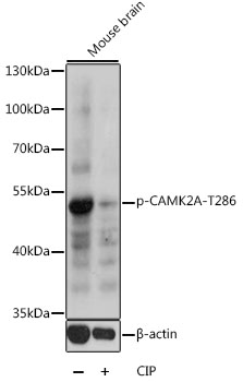 Anti-Phospho-Camk2a-T286 Antibody (CABP0255)