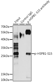 Anti-Phospho-HSPB1-S15 Antibody (CABP0040)