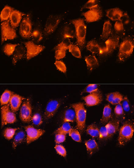 Anti-IGFBP5 Antibody (CAB12451)