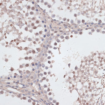 Anti-Cyclin E2 Antibody (CAB14086)