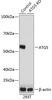 Anti-ATG5 Antibody [KO Validated] (CAB19677)