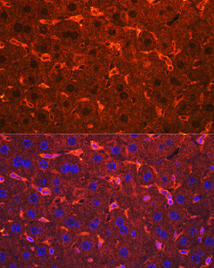 Anti-Ceruloplasmin Antibody (CAB13660)