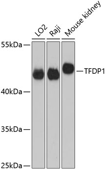 Anti-TFDP1 Antibody (CAB5422)