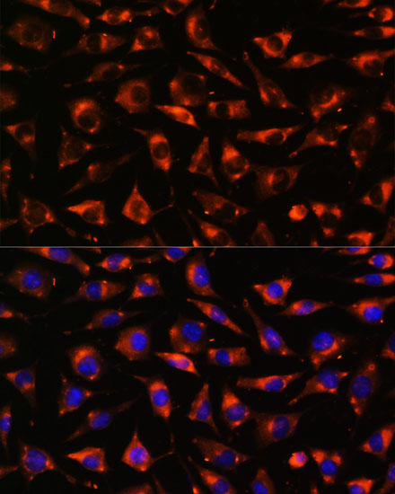 Anti-CYP17A1 Antibody (CAB13968)