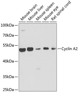 Anti-Cyclin A2 Antibody (CAB7632)