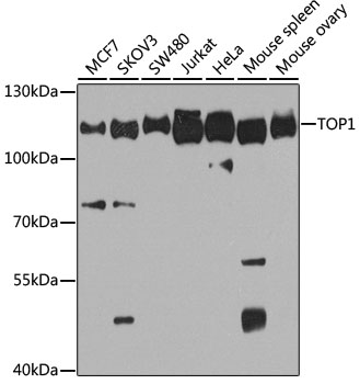 Anti-TOP1 Antibody (CAB12524)