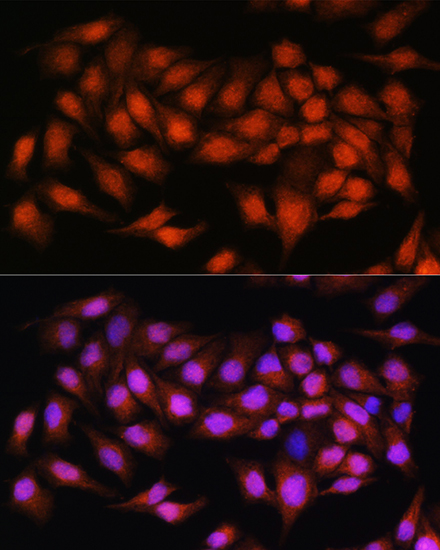 Anti-BCL3 Antibody (CAB11582)