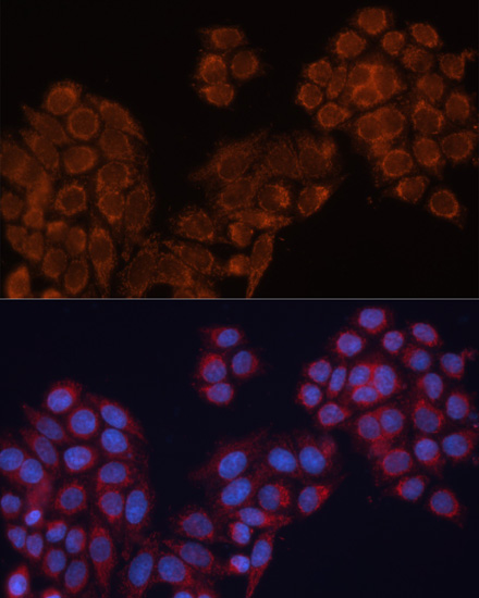 Anti-ALDH6A1 Antibody (CAB3309)