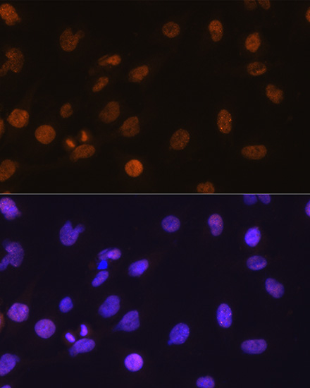 Anti-DDIT3 / CHOP Antibody (CAB0221)