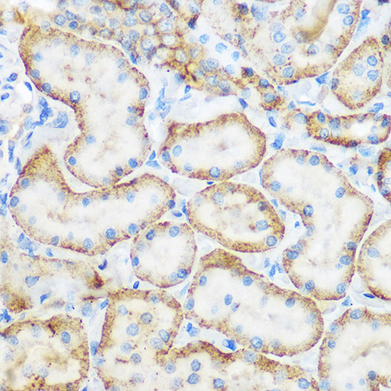 Anti-SELE Antibody (CAB2191)