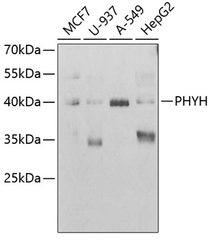 Anti-PHYH Antibody (CAB6304)