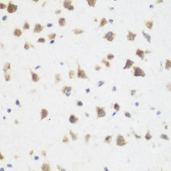 Anti-DHODH Antibody (CAB13295)