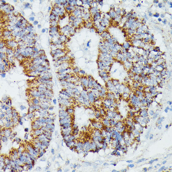 Anti-IVD Antibody (CAB15281)