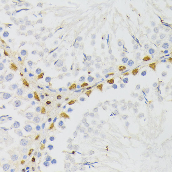 Anti-ELAC2 Antibody (CAB7128)