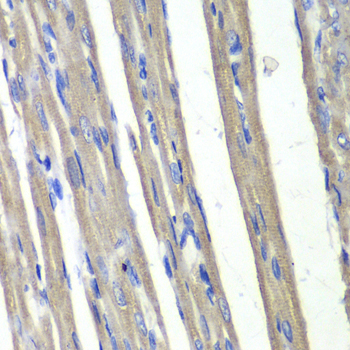 Anti-AKR1C3 Antibody (CAB13568)