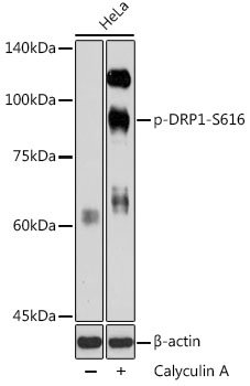 Anti-Phospho-DNM1L-S616 pAb (CABP0849)