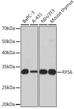 Anti-RPS6 Antibody (CAB6058)