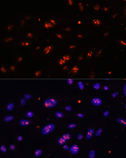 Anti-DKC1 Antibody (CAB12914)