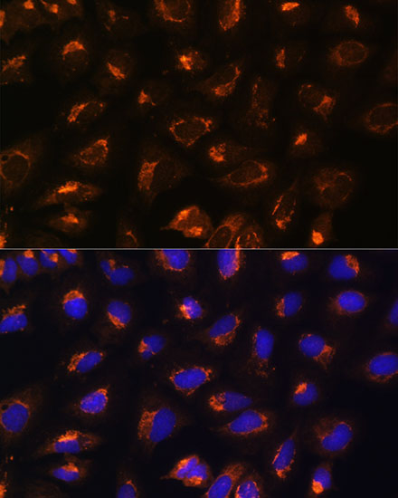 Anti-MAP2K2 Antibody [KO Validated] (CAB14770)