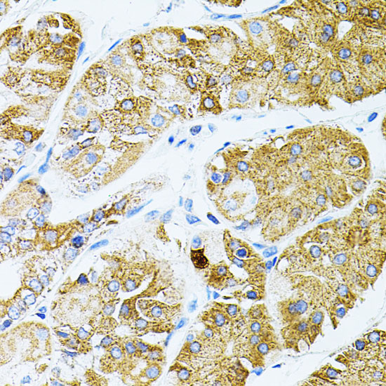 Anti-GNA13 Antibody [KO Validated] (CAB5746)