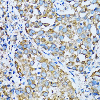 Anti-OGDH Antibody (CAB6391)