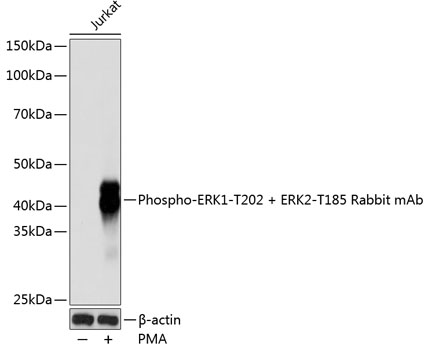 Anti-Phospho-ERK1-T202 + ERK2-T185 Antibody (CABP0485)