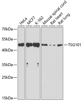 Anti-TSG101 Antibody (CAB1692)