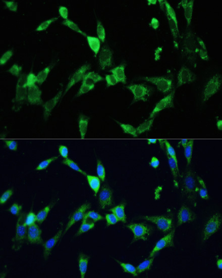 Anti-VEGFA Antibody (CAB16703)