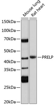 Anti-PRELP Antibody (CAB18573)