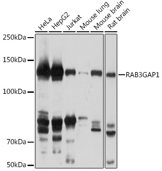 Anti-RAB3GAP1 Antibody (CAB18587)