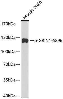 Anti-Phospho-GRIN1-S896 Antibody (CABP0165)