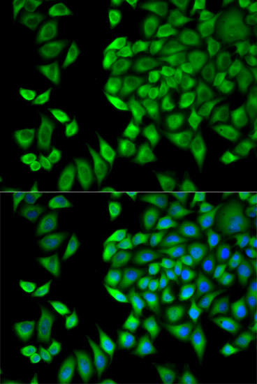 Anti-WNK1 Antibody (CAB2569)