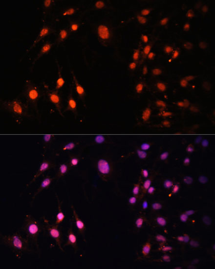 Anti-SETD2 Antibody (CAB3194)