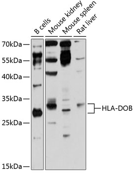 Anti-HLA-DOB Antibody (CAB12152)