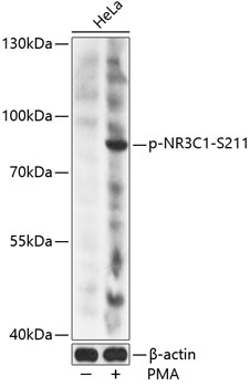 Anti-Phospho-NR3C1-S211 pAb (CABP0759)