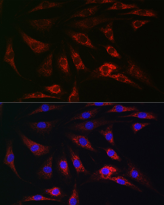 Anti-TOM20 Antibody [KO Validated] (CAB18047)