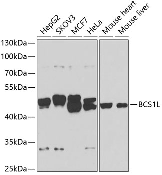 Anti-BCS1L Antibody (CAB7647)
