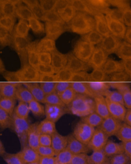 Anti-Beta-Tubulin Antibody (CABC015)