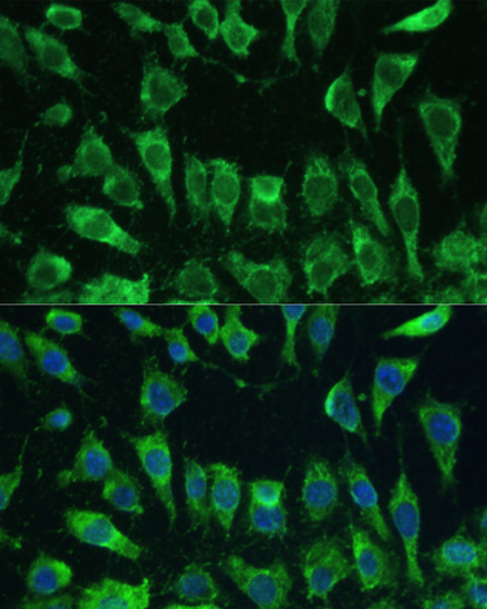 Anti-LGALS3 Antibody [KO Validated] (CAB13506)