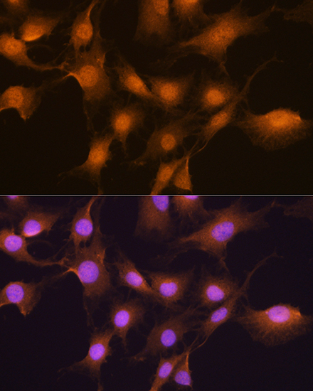 Anti-SKP2 Antibody (CAB7728)