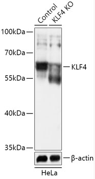 Anti-KLF4 Antibody [KO Validated] (CAB18088)